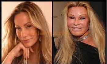A picture of Jocelyn Wildenstein before (left) and after (right).